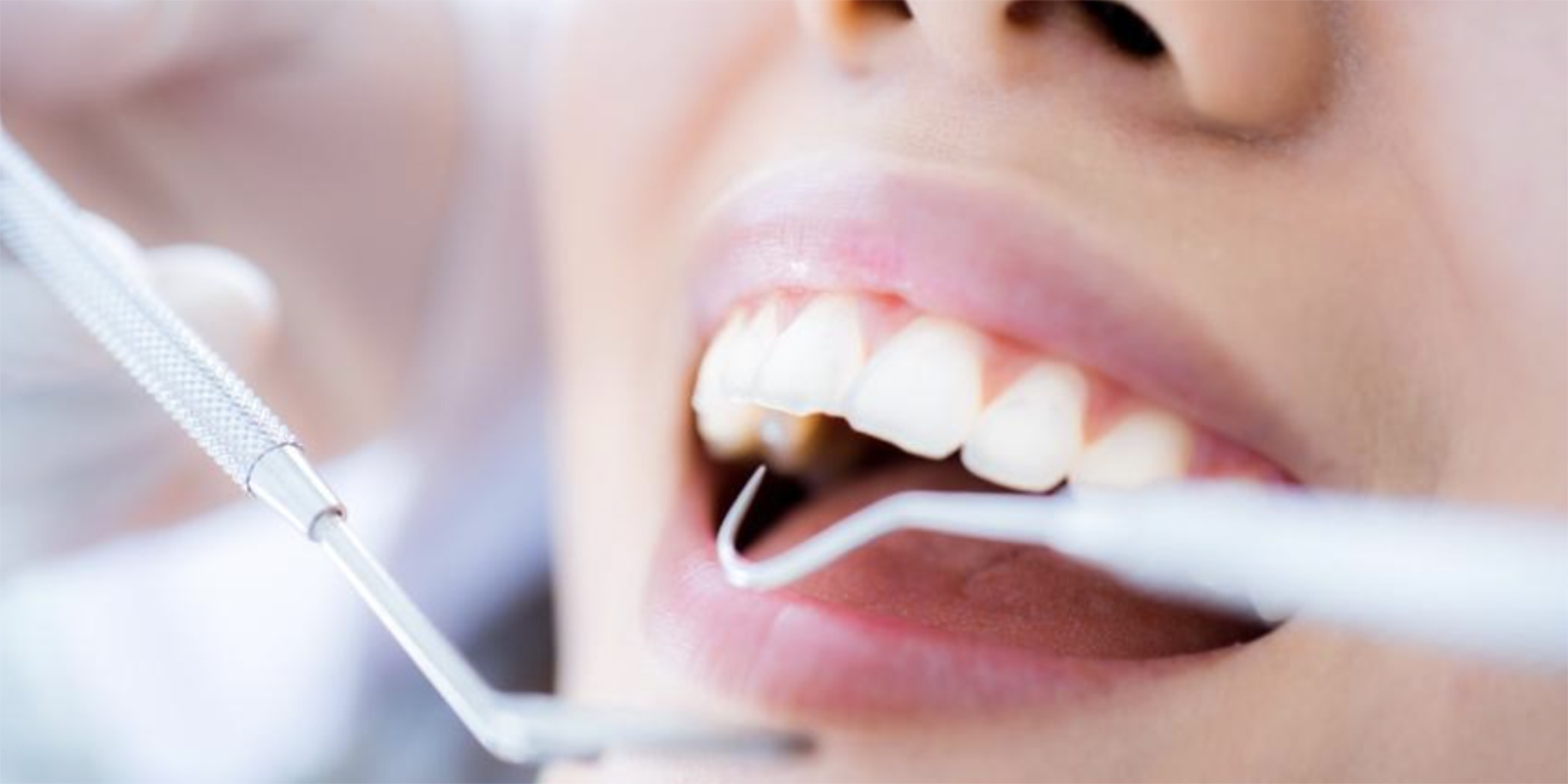 歯周病と全身疾患について